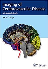 Imaging of Cerebrovascular Disease: A Practical Guide 1st Edition