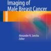 Imaging of Male Breast Cancer