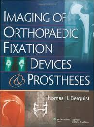 Imaging of Orthopaedic Fixation Devices and Prostheses Retail PDF