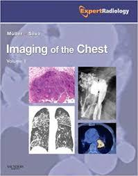 Imaging of the Chest, 2-Volume Set: Expert Radiology Series, 1e