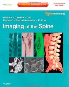 Imaging of the Spine: Expert Radiology Series, Expert Consult-Online and Print