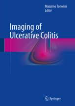 Imaging of Ulcerative Colitis