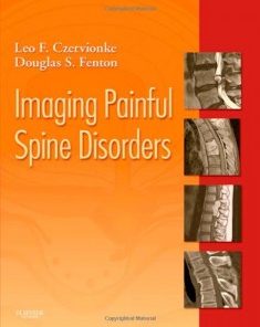 Imaging Painful Spine Disorders