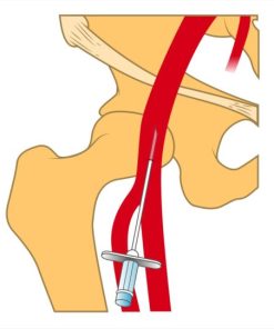 MRIOnline Imaging Mastery Series: Arterial Access – Principles, Pearls, Pitfalls, and Complications 2021 (CME VIDEOS)