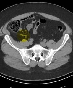 MRIOnline Imaging Mastery Series: Appendix 2021 (CME VIDEOS)