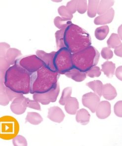 Current Concepts in Hematopathology 2022 (CME VIDEOS)