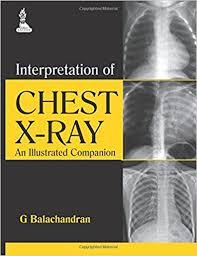 Interpretation of Chest X-ray: An Illustrated Companion