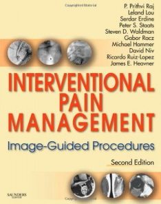 Interventional Pain Management: Image-Guided Procedure 2nd