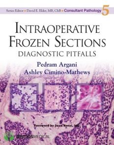 Intraoperative Frozen Sections: Diagnostic Pitfalls (Consultant Pathology)