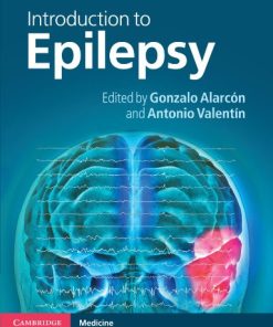 Introduction to Epilepsy