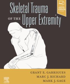 Skeletal Trauma of the Upper Extremity (EPUB)