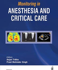 Monitoring in Anesthesia and Critical Care (PDF)