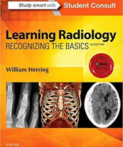 Learning Radiology: Recognizing the Basics