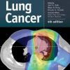 Lung Cancer, 4th Edition