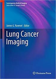 Lung Cancer Imaging (Contemporary Medical Imaging)