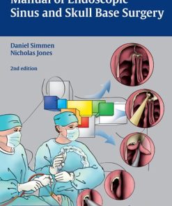 Manual of Endoscopic Sinus and Skull Base Surgery, 2nd Edition