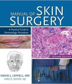 Manual of Skin Surgery: A Practical Guide to Dermatologic Procedures