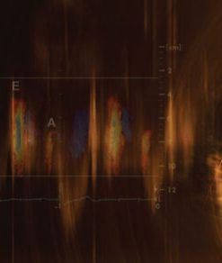 Mayo Clinic Echocardiography Online Board Review 2021 (Videos + Audios + Slides + Assessment)