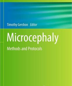 Microcephaly: Methods and Protocols (Methods in Molecular Biology, 2583) 1st ed. 2023 Edition PDF