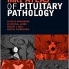 MRI Atlas of Pituitary Pathology