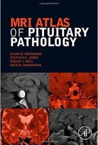 MRI Atlas of Pituitary Pathology