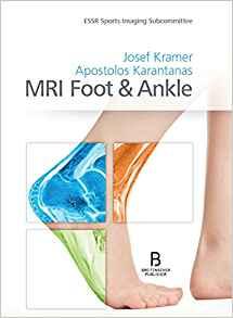 MRI Foot & Ankle