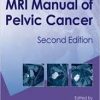 MRI Manual of Pelvic Cancer