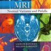 MRI Normal Variants and Pitfalls