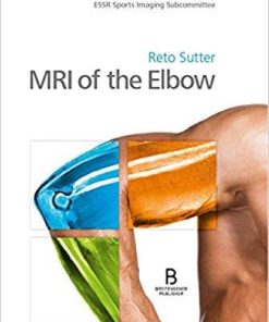 MRI of the Elbow (Englisch) Gebundene Ausgabe – 21. Februar 2018