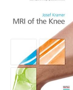 MRI of the Knee