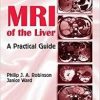 MRI of the Liver: A Practical Guide