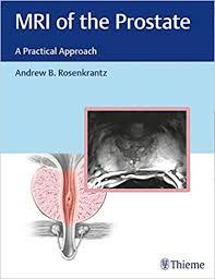 MRI of the Prostate: A Practical Approach