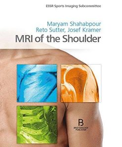 MRI of the Shoulder Kindle Edition