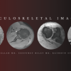 Musculoskeletal Imaging 2020 (CME VIDEOS)