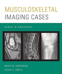 Musculoskeletal Imaging Cases (Cases in Radiology)