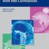 Musculoskeletal Ultrasound with MRI Correlations