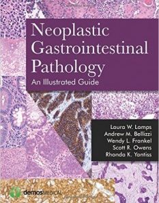 Neoplastic Gastrointestinal Pathology: An Illustrated Guide