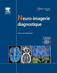 Neuro imagerie diagnostique, 2ème édition