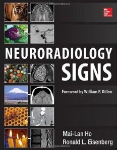 Neuroradiology Signs (PDF)