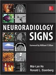 Neuroradiology Signs