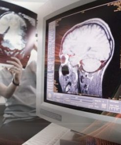 Penn Radiology Comprehensive Neuroradiology: Imaging Ideals 2022 (CME VIDEOS)