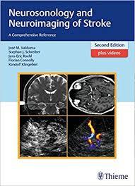 Neurosonology and Neuroimaging of Stroke: A Comprehensive Reference 2nd edition Edition