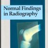 Normal Findings in Radiography