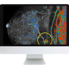 Breast Imaging Pearls and Pitfalls: Traditional and Novel Imaging Approaches 2020 (CME VIDEOS)