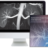 Multimodality Vascular Imaging: From Head to Toe 2020 (CME VIDEOS)