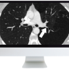 ARRS Basic Chest Imaging 2019 (CME VIDEOS)