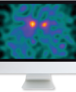 Clinical Case-Based Review of Nuclear Medicine 2019 (CME VIDEOS)