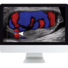 Clinical Ultrasound Review 2017 (ARRS VIDEOS) (CME VIDEOS)