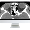 Imaging Victims of Violence Fists, Stabs, Bullets, and Blasts 2021 (CME VIDEOS)