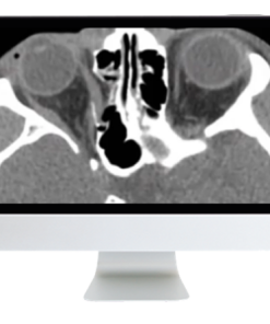 Imaging Victims of Violence Fists, Stabs, Bullets, and Blasts 2021 (CME VIDEOS)